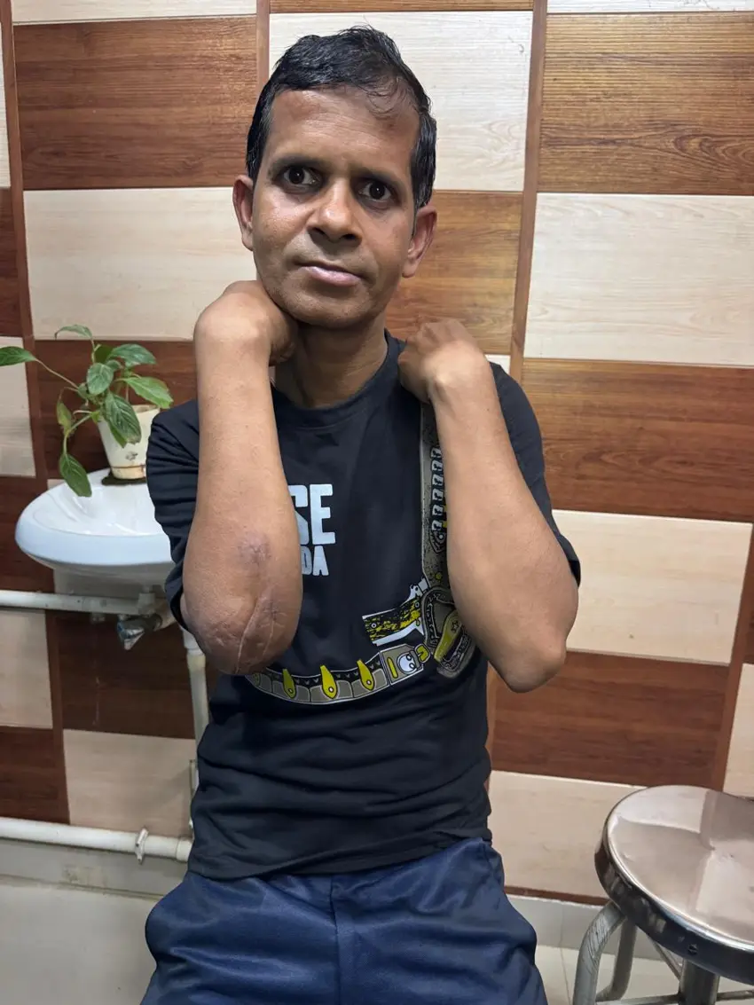 Patient demonstrating shoulder mobility after treatment